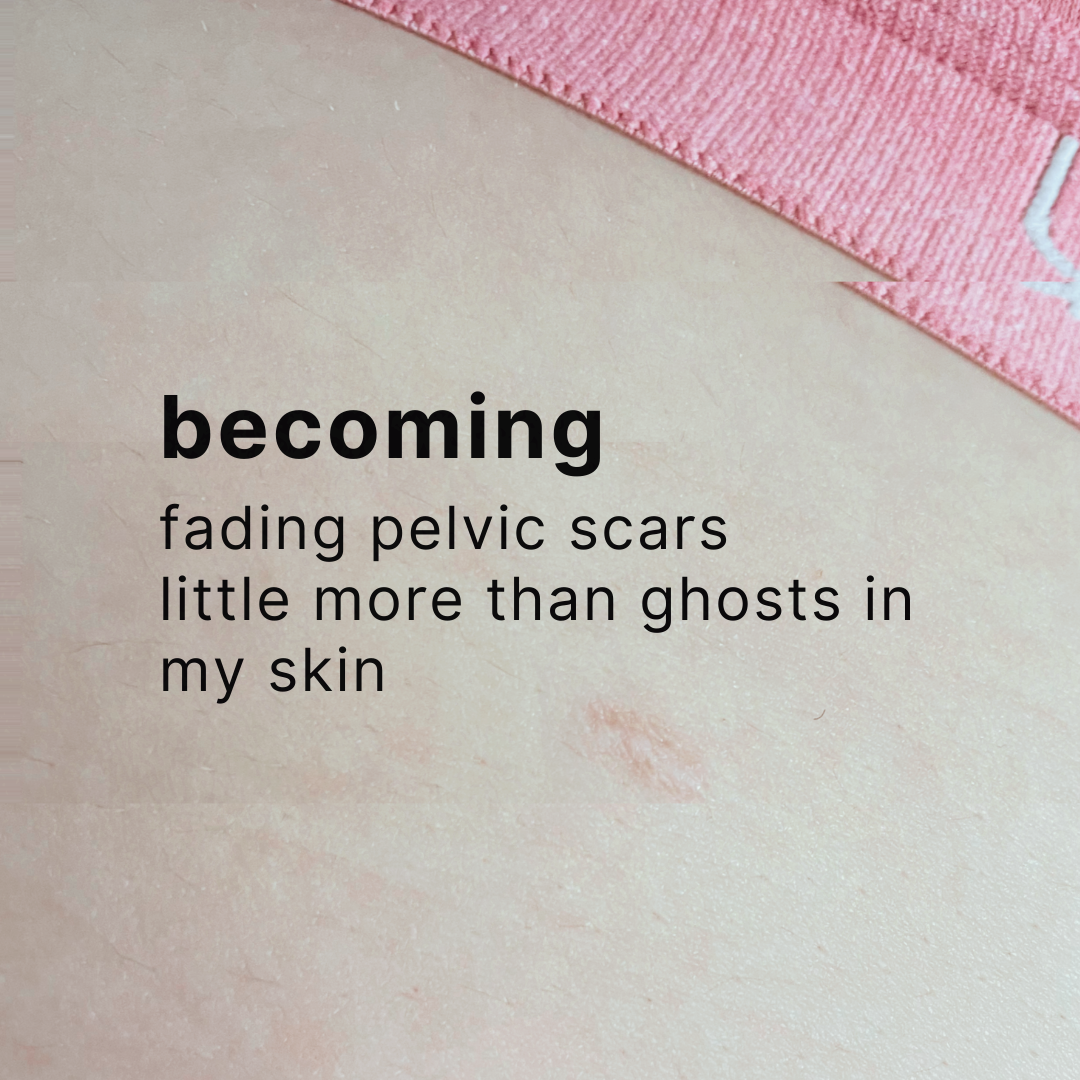 poem that reads 'becoming: fading pelvic scars / little more than ghosts in / my skin' over a slightly glitched image of an abdominal scar